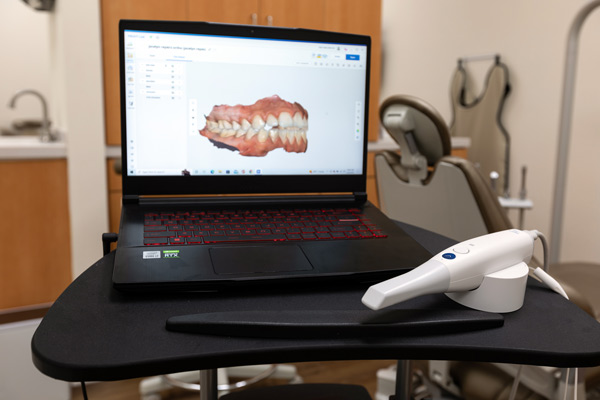 Intraoral scanner technology at Higher Ground Dentistry in Upland, CA