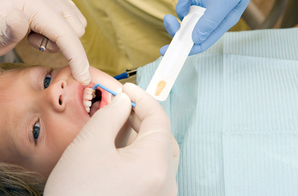 Young boy receiving fluoride treatment at dentist