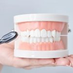 Hand holding dental model showing upper and lower teeth with pink gums