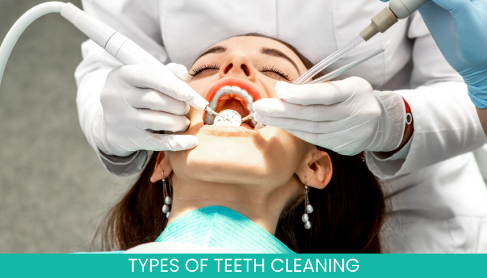 Types of teeth cleaning services showing dentist performing teeth cleaning procedure