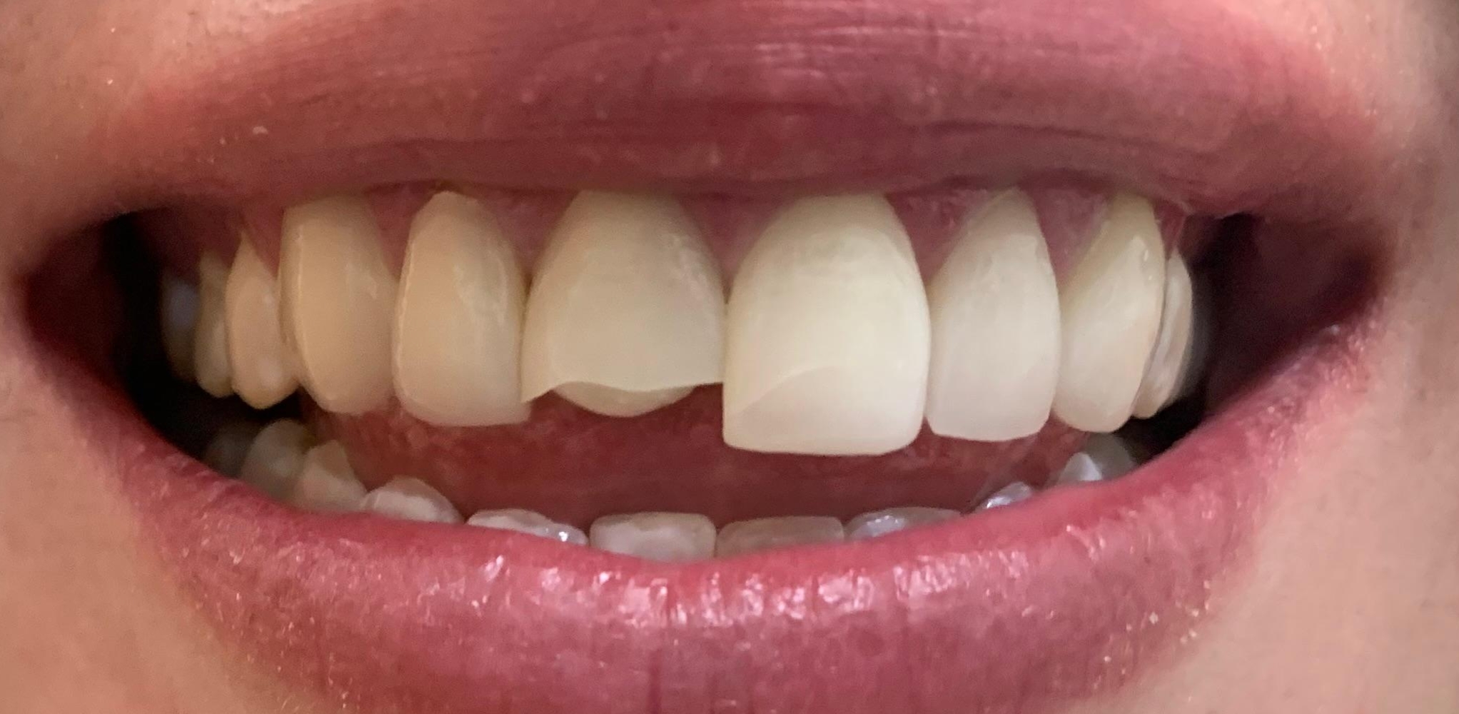 Close-up of a smiling mouth with teeth