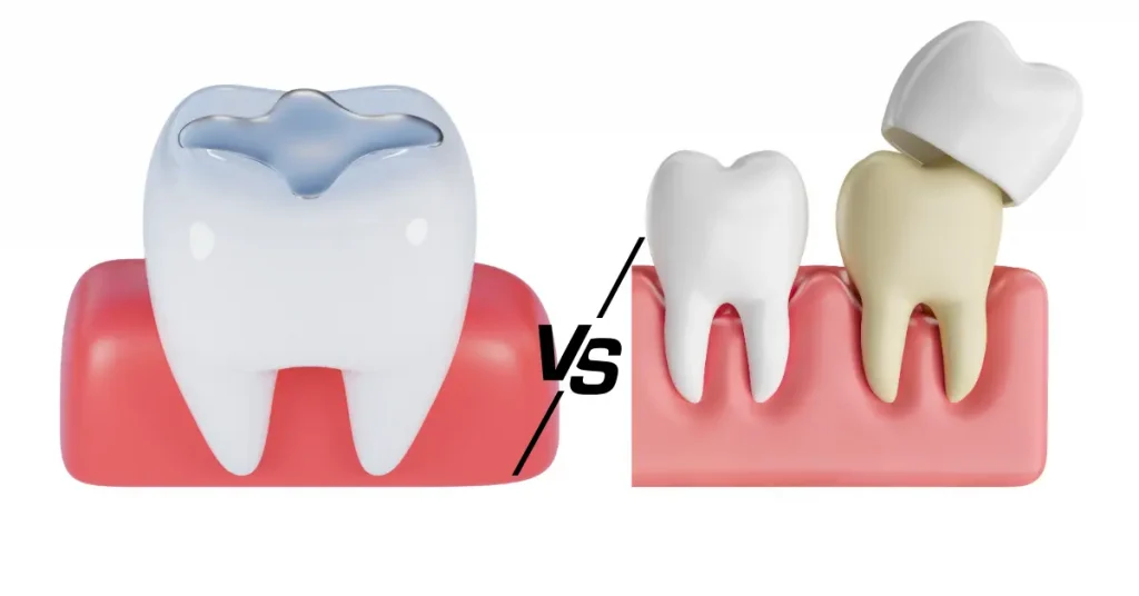 tooth filling vs dental crown comparison