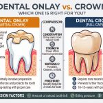Dental onlay vs crown comparison infographic showing differences in coverage, strength, and materials — Higher Ground Dentistry Upland CA