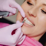 healthy snacks for teeth,halloween candy and teeth,sugar and teeth,how to protect teeth from candy