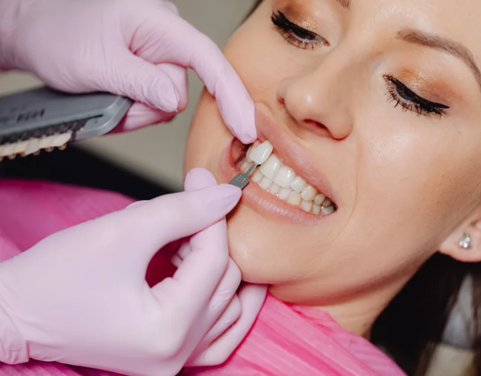 how long do veneers last,veneers fix gaps chips stain,veneers upland,fixing chipped stained uneven teeth veneers